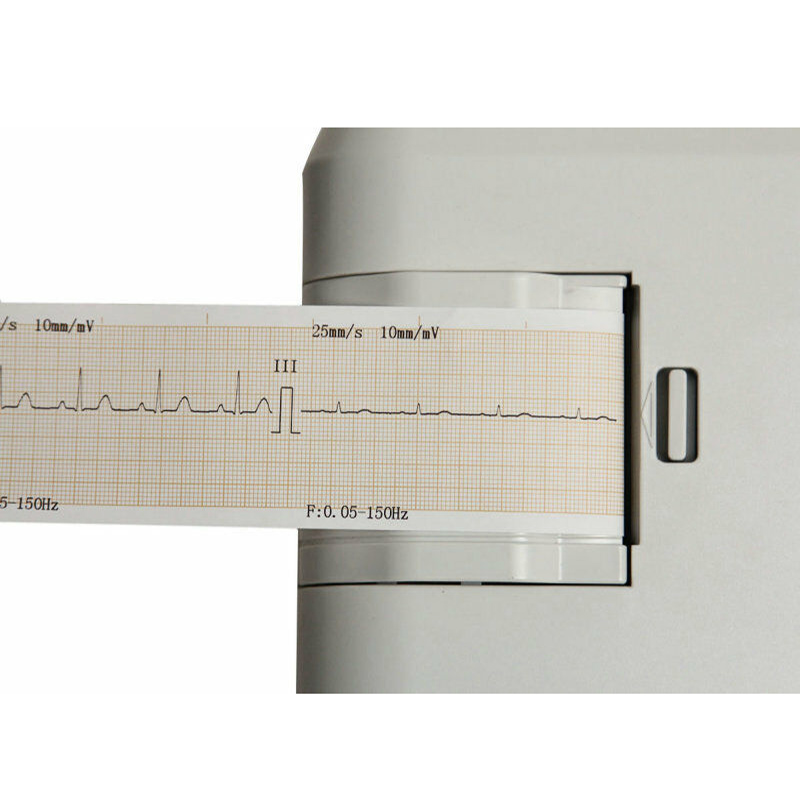 Mesin EKG Portabel Saluran Tunggal Hewan Peliharaan ECG100G-VET