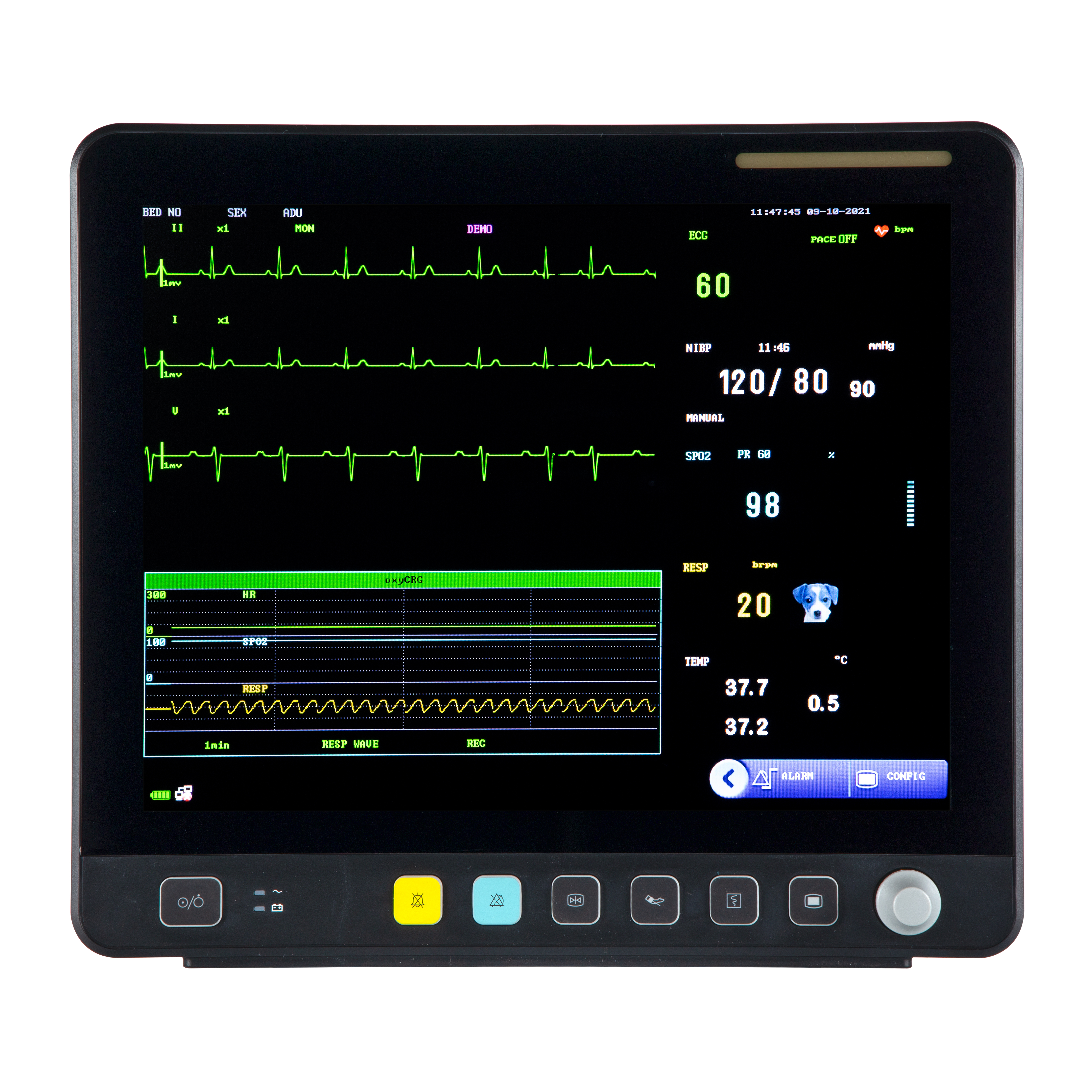 Monitor EKG Multiparameter Layar Sentuh Hewan VE15