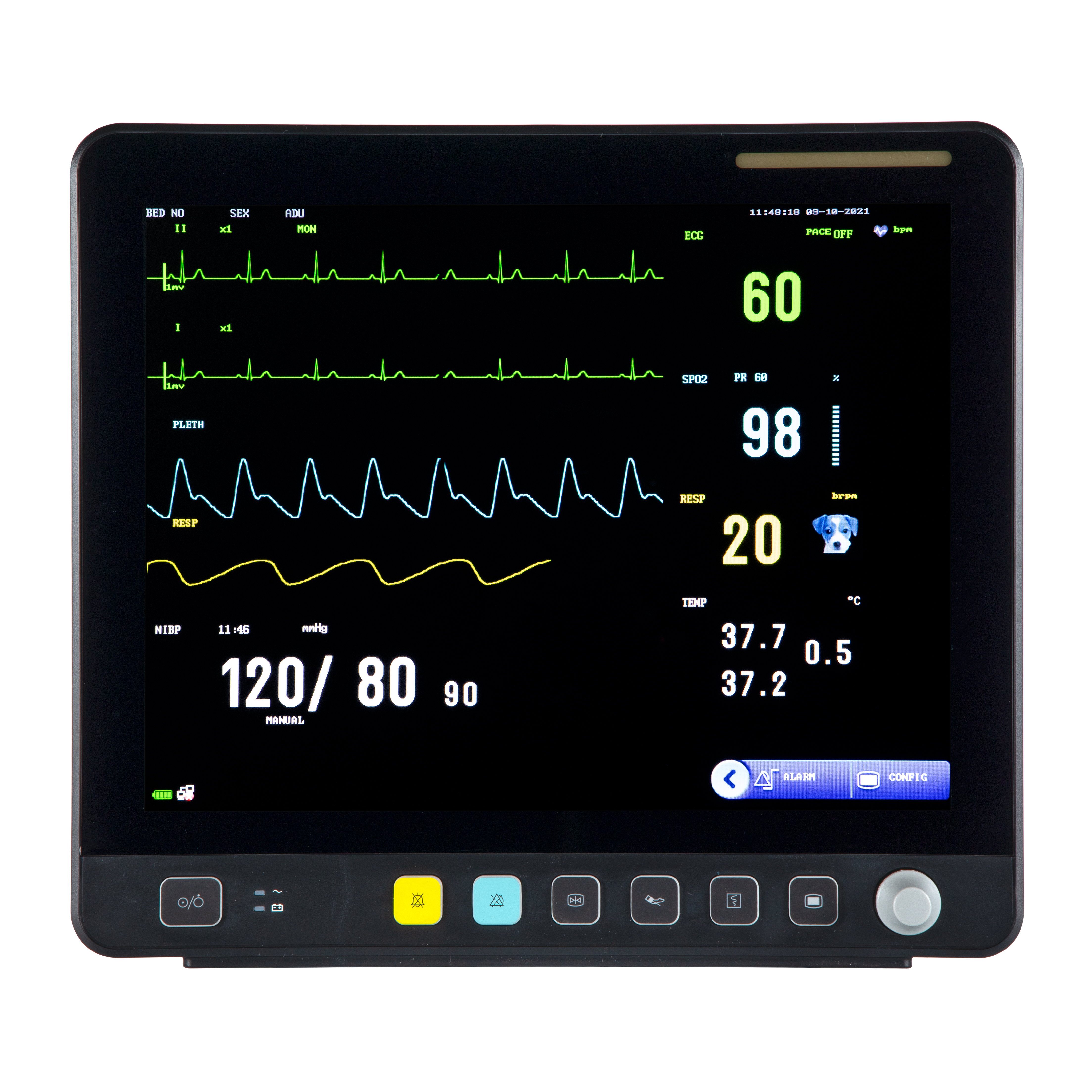 Monitor EKG Multiparameter Layar Sentuh Hewan VE15