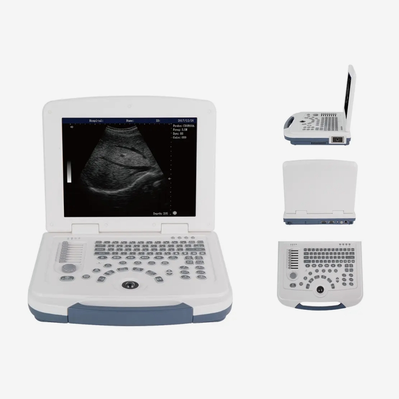 Pemindai Ultrasound Hewan Laptop Portabel 12,1 Inci untuk Hewan Besar CBV-MU10